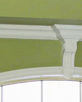 Brackets: A Timeless Touch of Strength and Style